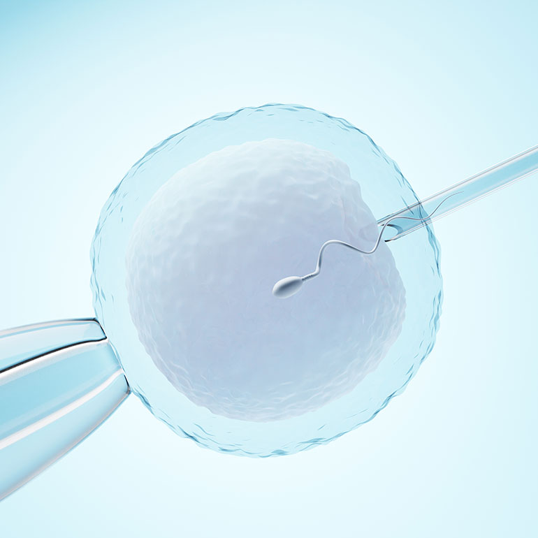 Intrauterine insemination